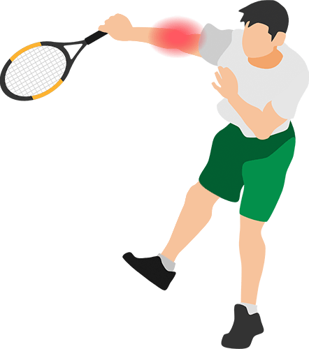 テニスをする人のイラスト